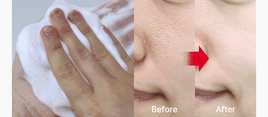 medi-peel collagen clear